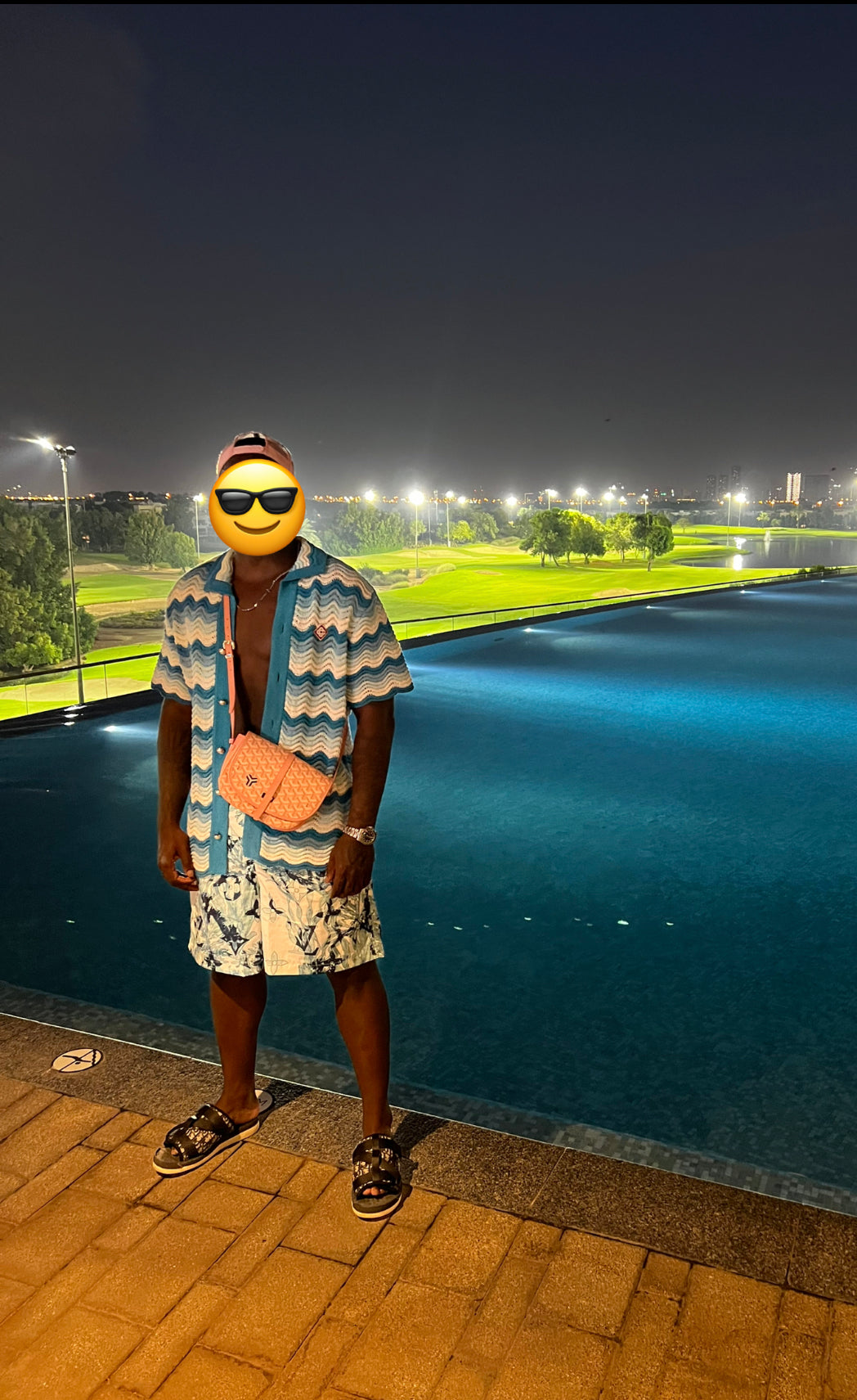 Casa B Blue Tropical Shirt 🏝️